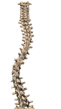 rotated spine